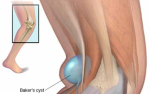 Hình ảnh tin tức Hội nghị sơ kết công tác Y tế 6 tháng đầu năm, triển khai nhiệm vụ 6 tháng cuối năm 2020.