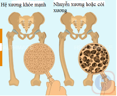 Trung tâm Y tế thành phố Yên Bái tham gia Chương trình “Hiến máu cứu người – nghĩa cử cao đẹp”