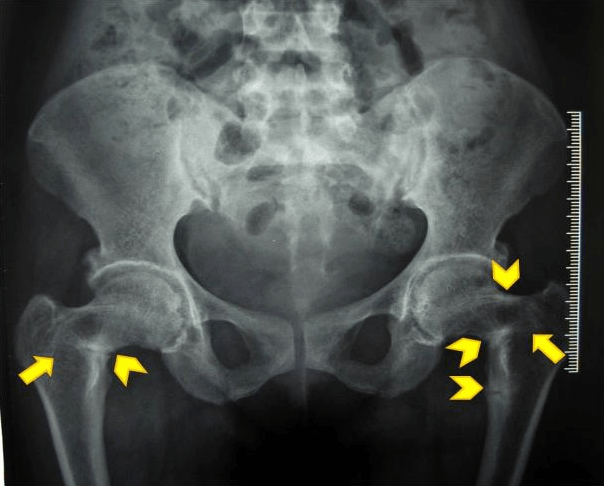 Trung tâm Y tế thành phố Yên Bái tổ chức Hội nghị tổng kết công tác Y tế, công tác công đoàn cơ sở năm 2019; Triển khai nhiệm vụ năm 2020.