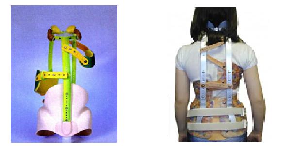 Hình ảnh tin tức Trung tâm Y tế thành phố Yên Bái cứu sống người bệnh chửa ngoài tử cung vỡ có choáng