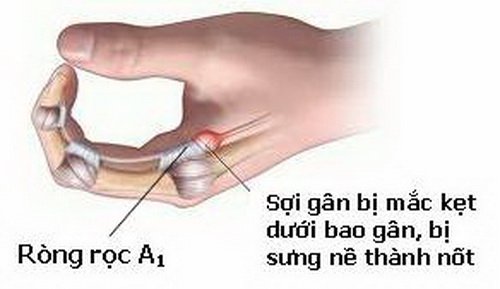 Công đoàn Trung tâm Y tế thành phố Yên Bái tổ chức ngày 1-6 cho các cháu thiếu nhi