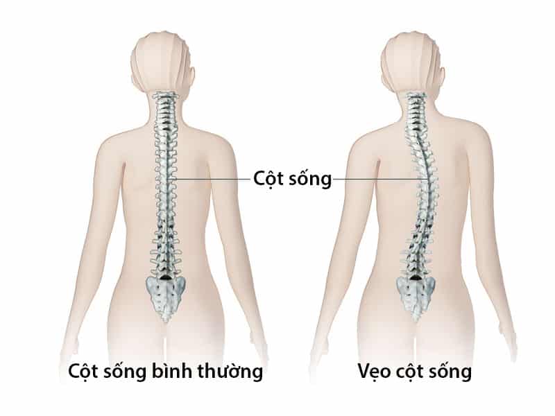 Hình ảnh tin tức 6.175 liều vắc xin phòng COVID – 19 được tiêm trong Chiến dịch đợt 1 của Trung tâm Y tế thành phố Yên Bái.