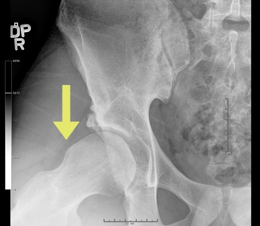 Hình ảnh tin tức Trung tâm Y tế thành phố Yên Bái tổ chức tập huấn chương trình vệ sinh môi trường năm 2019