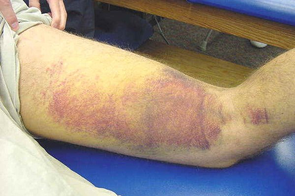 Hội Hoa Lan Việt Nam, Quỹ Phát Triển Hoa Lan Việt Nam thăm,  tặng quà Trung tâm Y tế thành phố Yên Bái