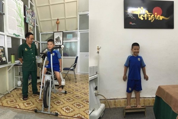 Nguyên nhân mất thính lực và cách khắc phục