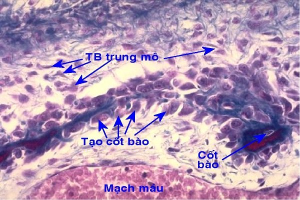 Infographic “Hướng dẫn tạm thời về quản lý người nhiễm COVID-19 tại nhà”