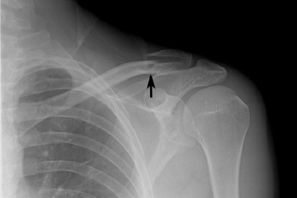 Hình ảnh tin tức Đẩy mạnh tuyên truyền thực hiện nghiêm yêu cầu 5K và thông điệp 5T