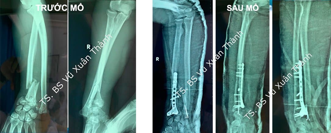 Hình ảnh tin tức Hưởng ứng Tuần lễ Dinh dưỡng và Phát triển (16 - 23/10): Dinh dưỡng đầy đủ và hợp lý để nâng cao sức khoẻ, góp phần chiến thắng đại dịch COVID-19